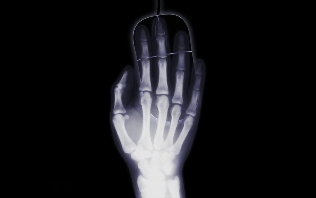 hand, roentgen, x-ray image-1366938.jpg